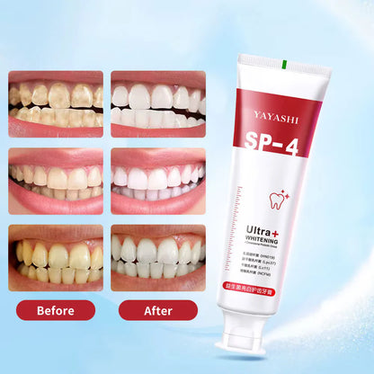 50% Off Discount Sp-4 Toothpaste (120g) Advanced Whitening Formula