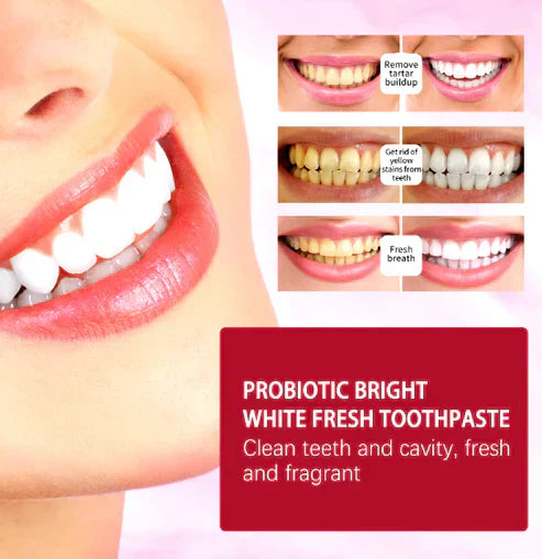 50% Off Discount Sp-4 Toothpaste (120g) Advanced Whitening Formula